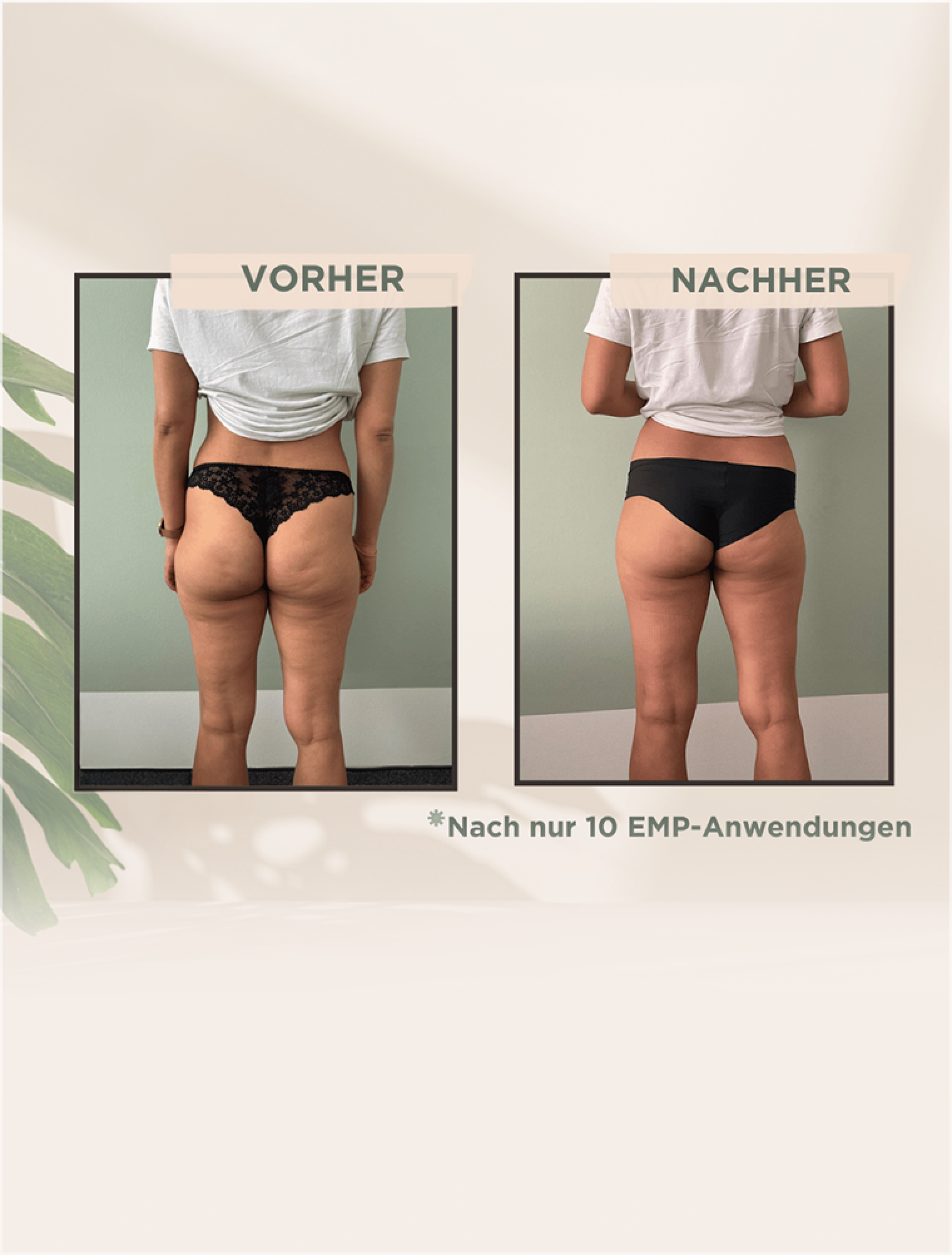 EMPulse Ergebnis: strafferer Po nach 10 Anwendungen