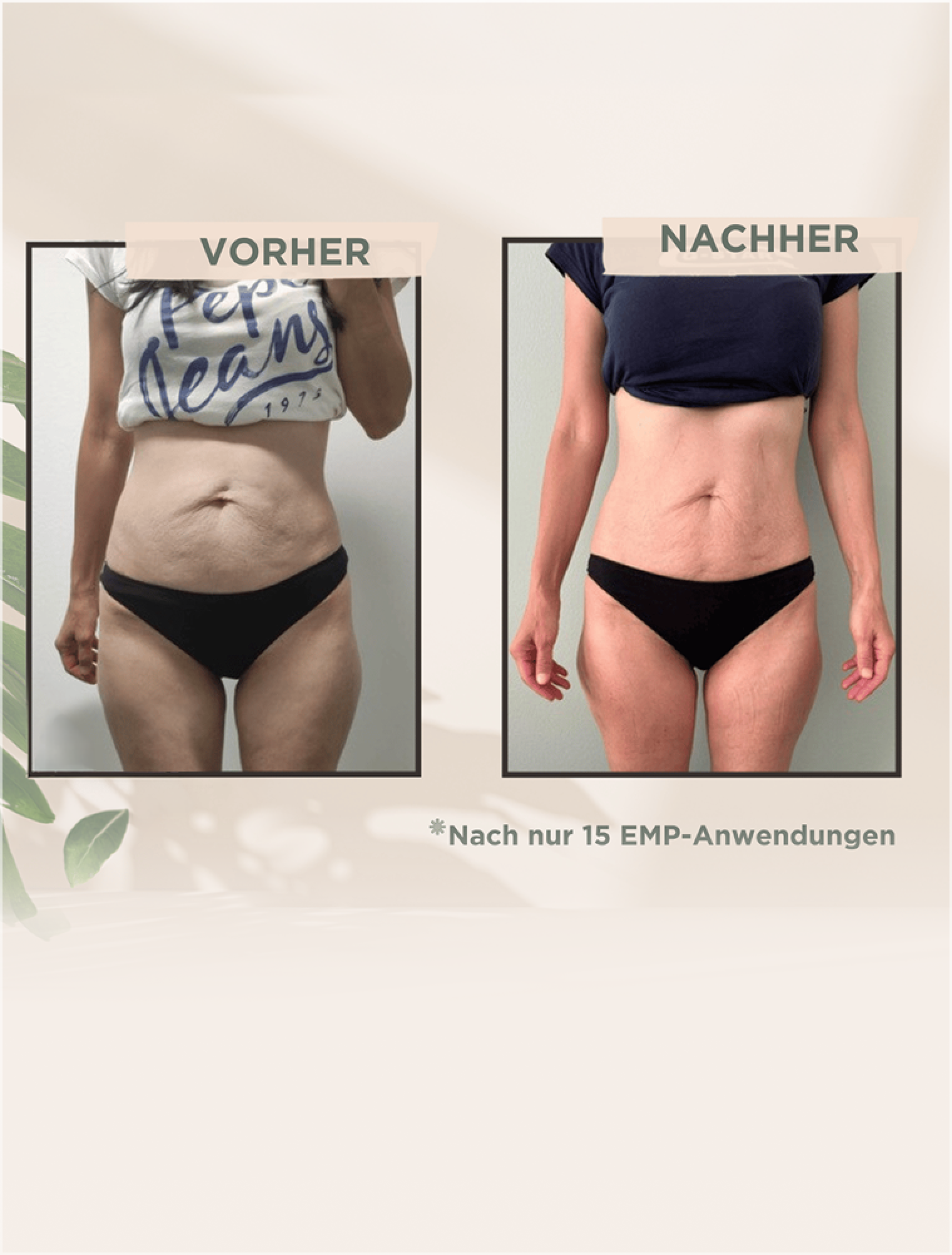 EMPulse Ergebnis: definierte Körpermitte nach 15 Anwendungen