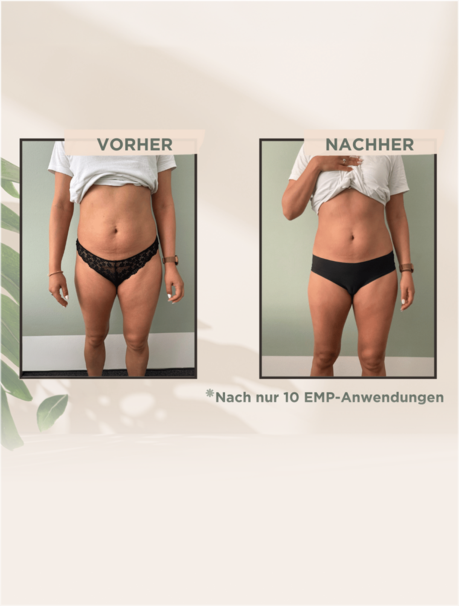 EMPulse Ergebnis: sichtbar definierter Bauch